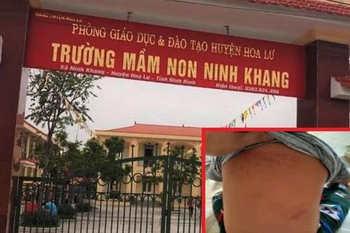Cô giáo bạo hành trẻ 15 tháng tuổi nói gì trong bản tường trình?
