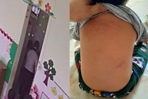 Đình chỉ giảng dạy 2 cô giáo vụ bạo hành trẻ 15 tháng tuổi