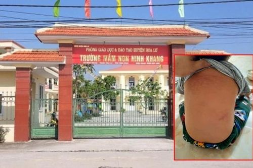 Trẻ mầm non 15 tháng tuổi bị giáo viên bạo hành trong nhà vệ sinh, dọa cho uống nước bồn cầu