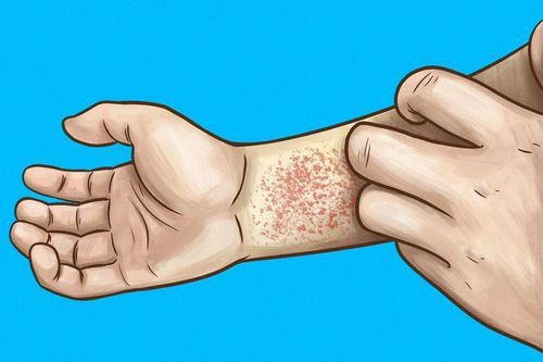 Những dấu hiệu cho thấy thận của bạn đang có vấn đề