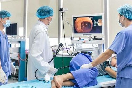 Thuốc mới dùng uống trước khi nội soi đại tràng: Những lưu ý khi dùng