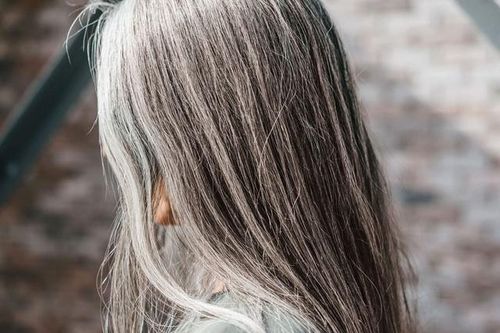 7 nguyên nhân khiến người trẻ có tóc bạc