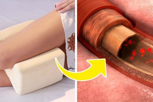 Tại sao bạn nên kẹp gối ở giữa hai chân khi ngủ?