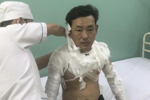 Nghi phạm tẩm xăng cướp ngân hàng ở TP.HCM khai gì?