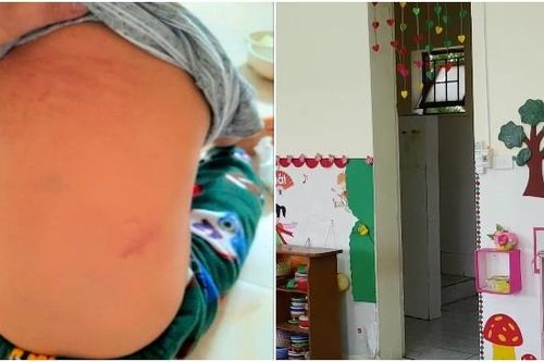 Điểm nhấn giáo dục: Hai giáo viên mầm non bị tố bắt trẻ uống nước bồn cầu