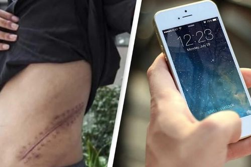 Bán thận để mua iPhone và iPad, một chàng trai đã phải nằm liệt giường suốt đời