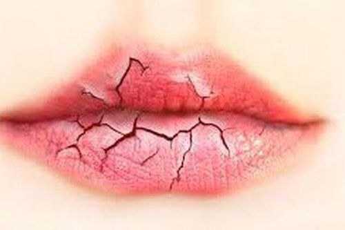 Bí quyết có đôi môi đẹp không nứt nẻ vào mùa đông