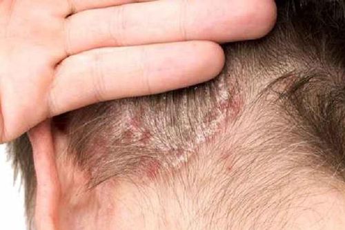 Nguy cơ ung thư từ thuốc nhuộm tóc