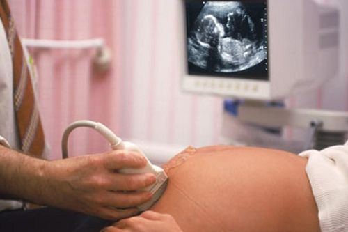 Hơn 40.000 trẻ không được chào đời vì là con gái