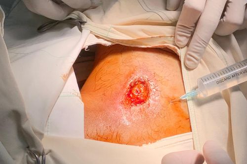 BV Quốc tế Minh Anh nói gì về vụ bệnh nhân thử máy X-quang nhập viện?