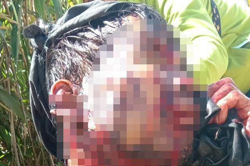 Quảng Nam: Người đàn ông nguy kịch khi bị gấu rừng tấn công