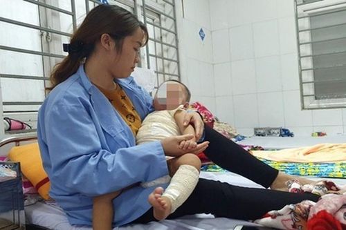 Chữa bỏng thầy lang với giá 25 triệu đồng, bé trai hoại tử nặng