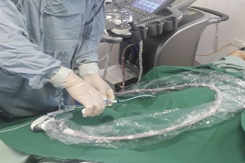 Người đàn ông 60 tuổi bị apces gan được dẫn lưu ngay tại khoa cấp cứu