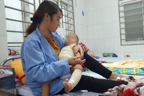 Thầy lang chữa bỏng với giá 25 triệu khiến bé bị hoại tử da