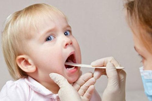 Khô miệng có thể là biểu hiện bệnh lý