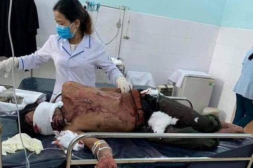 Thông tin mới nhất vụ người đàn ông bị gấu rừng tấn công ở Quảng Nam