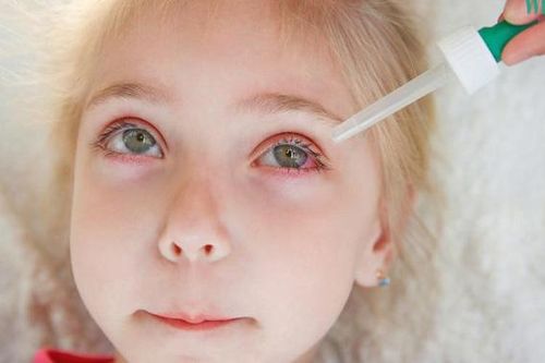 Chăm sóc trẻ bị đau mắt đỏ như thế nào mới đúng cách?
