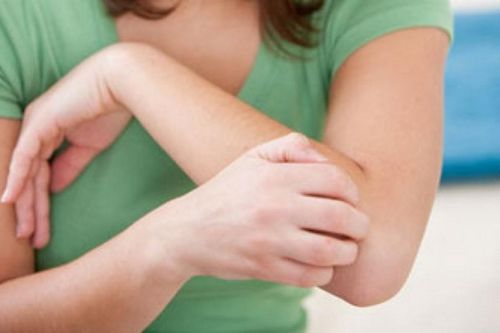 Nhiều người nhiễm bệnh về da do nuôi thú cưng