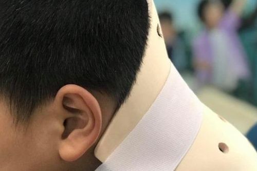 Bắt chước trò nhào lộn trên Tiktok, bé trai chấn thương cột sống cổ