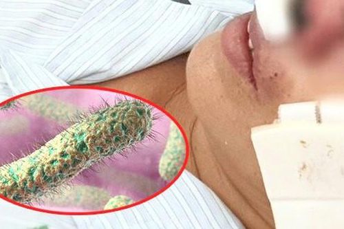 9 bệnh nhân mắc bệnh 'vi khuẩn ăn thịt người' Whitmore