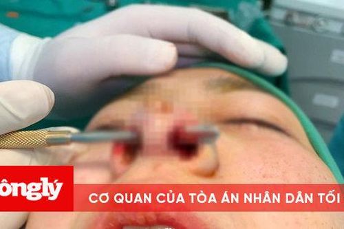 Thủng mũi do làm đẹp, cô gái trẻ bị spa tiêm mông 'chữa cháy'