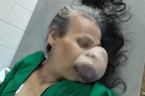 Tìm thân nhân bệnh nhân nữ không rõ danh tính tử vong sau khi đuối nước