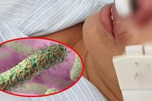 9 trường hợp ở Quảng Trị bị nhiễm vi khuẩn 'ăn thịt người'