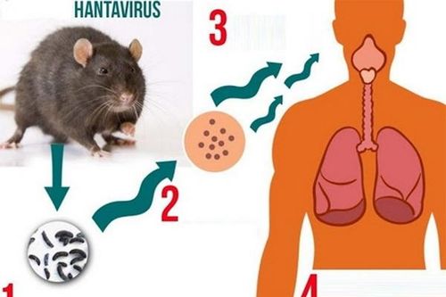 Phân biệt COVID-19 và nhiễm virus Hanta