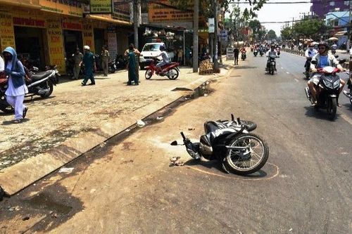 Nam thanh niên bị tạt axit khi đang đi chơi với bạn gái