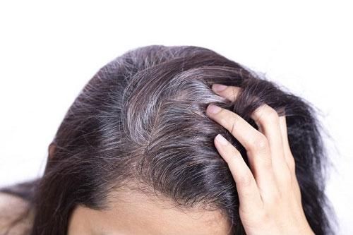 Cần loại bỏ ngay những điều này nếu không muốn tóc bị bạc sớm