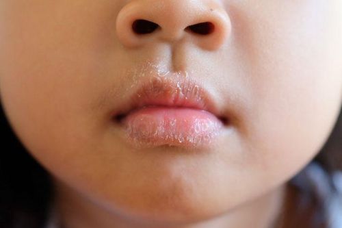 Những dấu hiệu cảnh báo bệnh nguy hiểm bạn cần chú ý