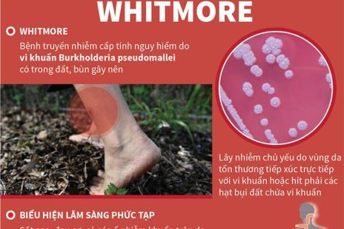 Bộ Y tế yêu cầu tăng cường chẩn đoán, điều trị bệnh Whitmore