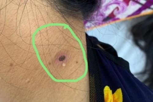 Cẩn trọng với cơn... sốt mò
