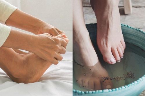 5 'bí kíp' giúp chân không bị nứt toác khô tróc mùa Thu Đông