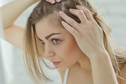 Da đầu thường tróc vảy, mẩn đỏ - nguyên nhân và cách điều trị