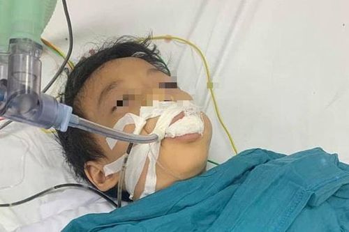 Bé gái 6 tuổi ăn nhầm thuốc diệt chuột