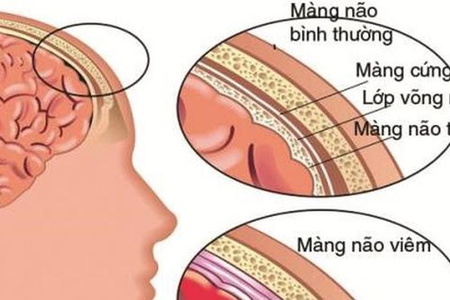 Khi nào biến chứng của bệnh tay chân miệng xuất hiện?