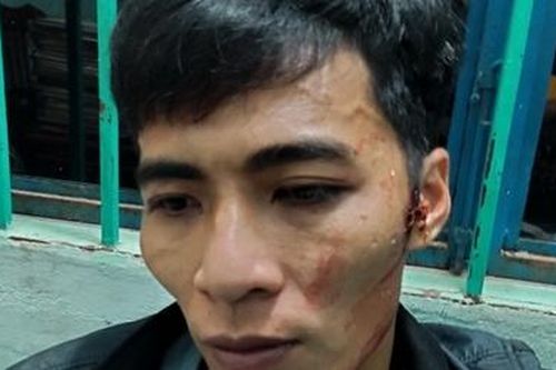 Bắt giữ kẻ cướp giật ở miền núi sau nửa giờ truy nóng