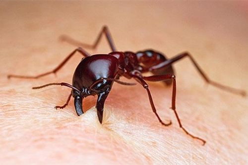 Làm gì khi bị kiến cắn?
