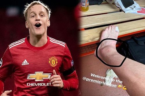 Chân Van de Beek biến dạng sau trận đấu với Southampton
