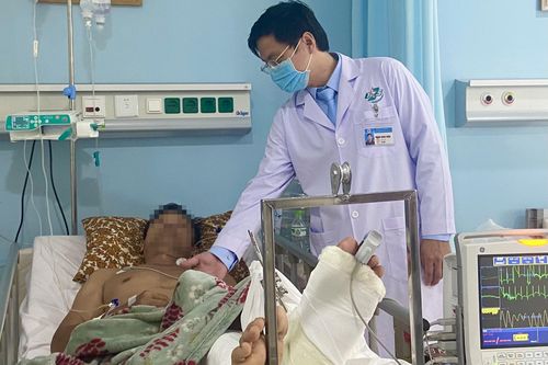Nối chi thành công cho bệnh nhân bị chém đứt chân