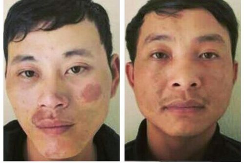 Bắt 2 kẻ 'ôm' ma túy
