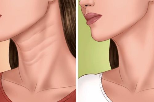 6 thói quen đơn giản 'trẻ hóa' cổ trong nháy mắt