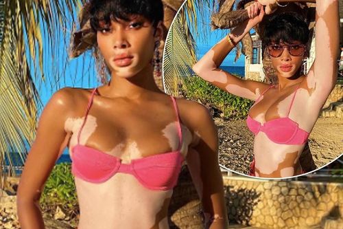 Winnie Harlow quyến rũ hút hồn giữa biển tuyệt đẹp ở Jamaica