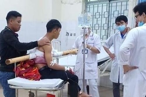 Thông tin mới nhất vụ nam thanh niên bị cây gỗ keo đâm xuyên ngực