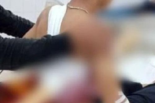 Sức khỏe của nam thanh niên bị khúc keo đâm xuyên người giờ ra sao?