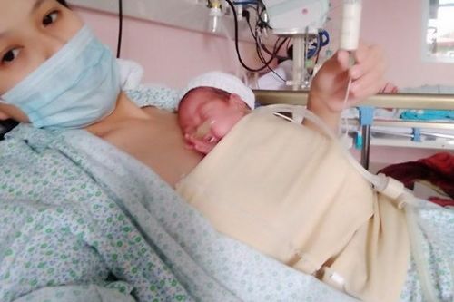 Sự phối hợp tuyến trên với tuyến dưới: Hành trình kỳ diệu của bé sơ sinh cực non tháng