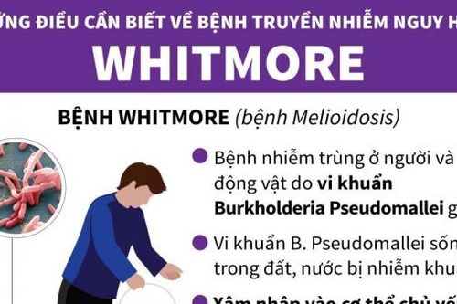 Những điều cần biết về bệnh truyền nhiễm nguy hiểm Whitmore