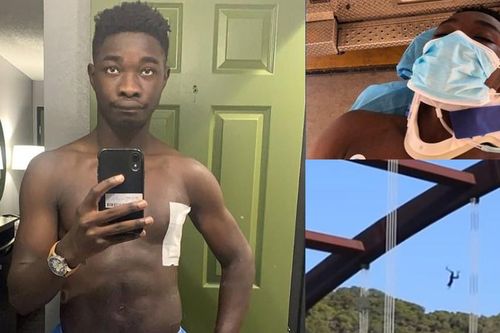 YouTuber bị nứt hộp sọ vì làm video nhảy cầu để hút người xem, bị phản ứng gay gắt