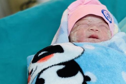 Hàng chục y bác sĩ 2 bệnh viện mổ bắt con cho sản phụ ung thư ở tư thế ngồi